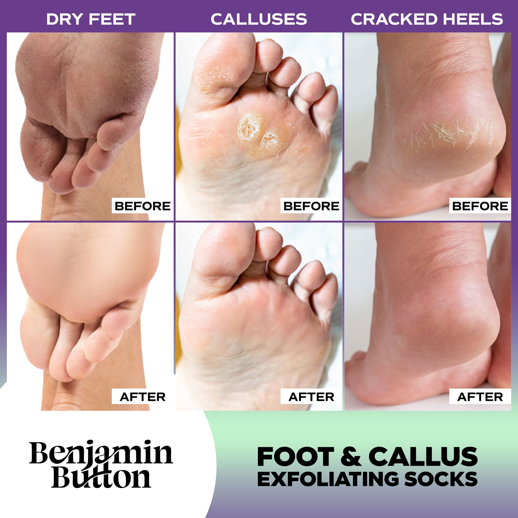 Exfoliating Foot Masks